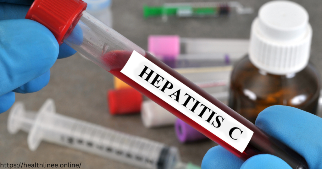 Hepatitis C Medication