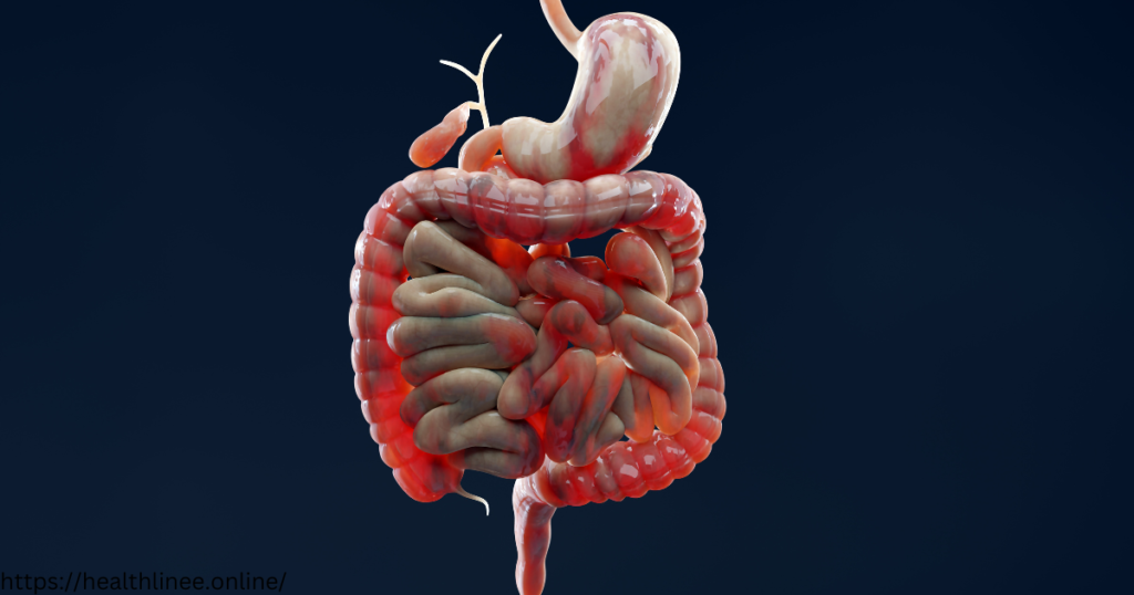 Crohn's Disease: Symptoms, Types, Causes, Diagnosis, & Treatment