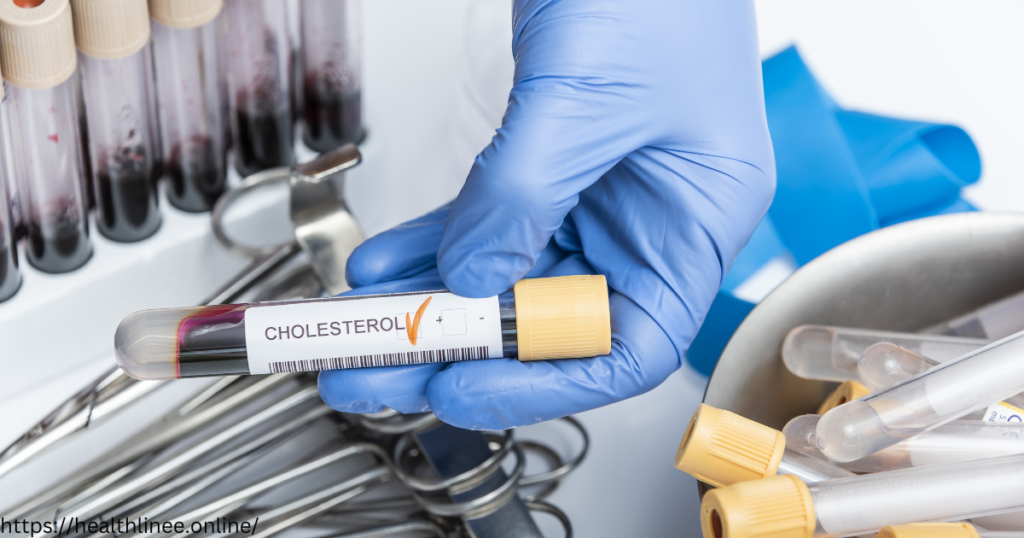 High Cholesterol Treatment:
